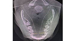 Content Dam Diq Online Articles 2018 08 18aug23bcwilkersont Content Dam Diq Online Articles 2018 08 18aug23bcwilkersont