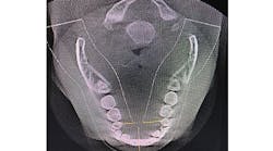 Content Dam Diq Online Articles 2018 08 18aug23bcwilkersont Content Dam Diq Online Articles 2018 08 18aug23bcwilkersont