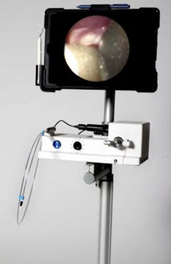 Fortune Wedpnae Endoscope Fig00 Fortune Wedpnae Endoscope Fig00