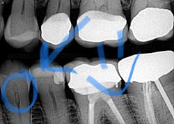 18oct25bcedblog01 18oct25bcedblog01