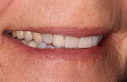 18oct25bcsisler02 18oct25bcsisler02