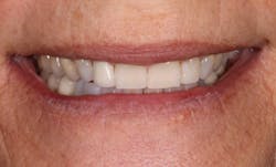 18oct25bcsisler03 18oct25bcsisler03