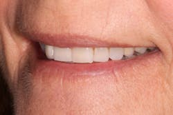 18oct25bcsisler04 18oct25bcsisler04