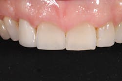 18oct25bcsisler06 18oct25bcsisler06