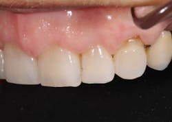 18oct25bcsisler07 18oct25bcsisler07