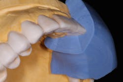 18oct25bcsisler08 18oct25bcsisler08