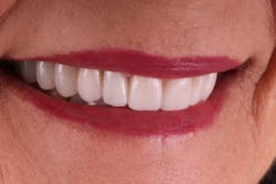 18oct25bcsisler10 18oct25bcsisler10