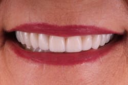 18oct25bcsisler11 18oct25bcsisler11