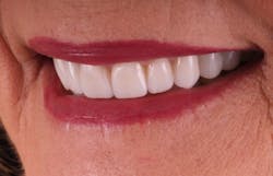 18oct25bcsisler12 18oct25bcsisler12