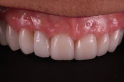 18oct25bcsisler13 18oct25bcsisler13