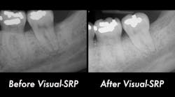 Content Dam Diq Online Articles 2018 09 Fortune Endoscopy Casereview Diqthumb 03 Content Dam Diq Online Articles 2018 09 Fortune Endoscopy Casereview Diqthumb 03