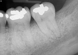 Fortune Endoscopy Casereview 18 Postop 500w Fortune Endoscopy Casereview 18 Postop 500w