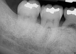 Fortune Endoscopy Casereview 31 Postop 500w Fortune Endoscopy Casereview 31 Postop 500w