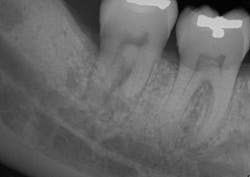 Fortune Endoscopy Casereview 31 Preop 500w Fortune Endoscopy Casereview 31 Preop 500w