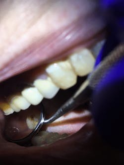 Roszel Rivastar Review Postapplication Ki No2 Roszel Rivastar Review Postapplication Ki No2