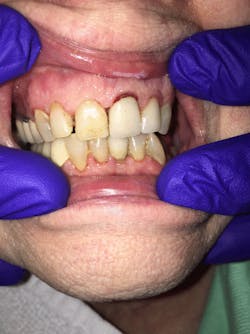 Roszel Rivastar Review Postapplication Ki No9 Roszel Rivastar Review Postapplication Ki No9