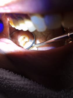 Roszel Rivastar Review Preapplication No2 Roszel Rivastar Review Preapplication No2