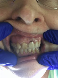 Roszel Rivastar Review Preapplication No9 Roszel Rivastar Review Preapplication No9