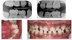 18nov15bcsmart04 18nov15bcsmart04