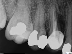 18nov15bczuroff01 18nov15bczuroff01