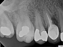 18nov15bczuroff05 18nov15bczuroff05