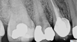 Content Dam Diq Online Articles 2018 11 18nov15bczurofft Content Dam Diq Online Articles 2018 11 18nov15bczurofft