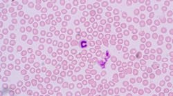 Content Dam Diq Online Articles 2018 11 Immune Disease Kupczyk Diqthumb Content Dam Diq Online Articles 2018 11 Immune Disease Kupczyk Diqthumb