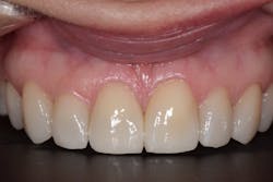 Sang Figure 11 Sang Figure 11