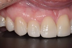 Sang Figure 12 Sang Figure 12