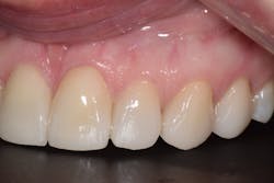 Sang Figure 13 Sang Figure 13