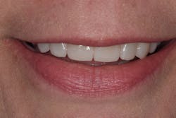 Sang Figure 14 Sang Figure 14