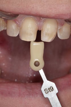 Sang Figure 8 Sang Figure 8