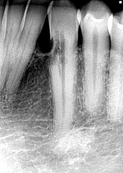 22 Resorption 22 Resorption