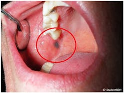 Figure 1: Unknown oral lesion