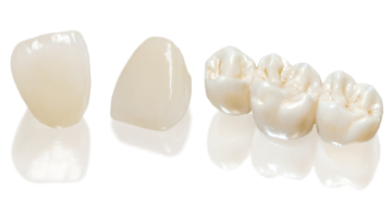 Content Dam Diq Online Articles 2016 12 Sundental Sunceram Zirconia Diqthumb