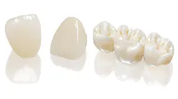 Content Dam Diq Online Articles 2016 12 Sundental Sunceram Zirconia Diqthumb