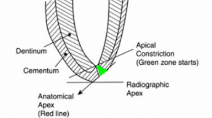 Root Canal Treatment Where Does The Apex End Dentistryiq