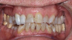 Content Dam Diq Online Articles 2017 01 17jan5bcednote Thumb Content Dam Diq Online Articles 2017 01 17jan5bcednote Thumb