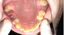 Content Dam Diq Online Articles 2017 01 Collins Case Study Jan2016 Diqthumb Content Dam Diq Online Articles 2017 01 Collins Case Study Jan2016 Diqthumb