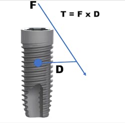 Figure 2: T = F x D (calculating torque on a dental implant) Figure 2: T = F x D (calculating torque on a dental implant)