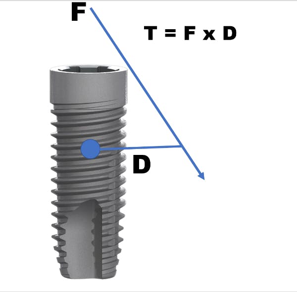 Figure 2: T = F x D (calculating torque on a dental implant)
