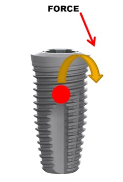 Figure 3: Bending moment Figure 3: Bending moment
