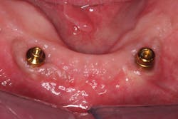 Figure 6: Equator (left) and Locator (right) Figure 6: Equator (left) and Locator (right)