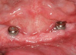 Figure 7: Exposed threads Figure 7: Exposed threads