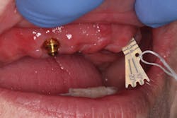 Figure 11: Selecting the proper angle. Figure 11: Selecting the proper angle.