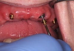 Figure 13: Placing the Equator Figure 13: Placing the Equator