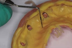 Figure 17: Left probe Figure 17: Left probe