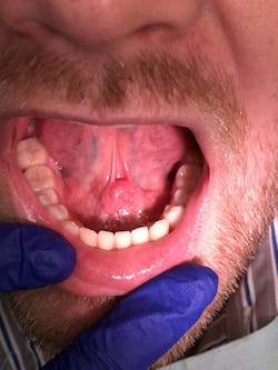 Figure 1: Patient presentation Figure 1: Patient presentation