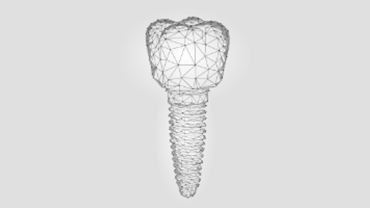 Content Dam Diq Online Articles 2019 02 Dental Implant Abstract 360x200