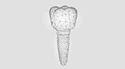 Content Dam Diq Online Articles 2019 02 Dental Implant Abstract 360x200 Content Dam Diq Online Articles 2019 02 Dental Implant Abstract 360x200